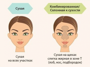 типы кожи