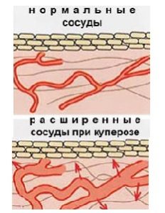 kuperos